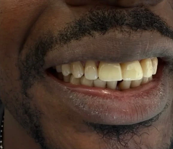 შემდეგ