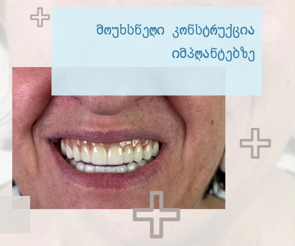 კბილების ფოტო 4